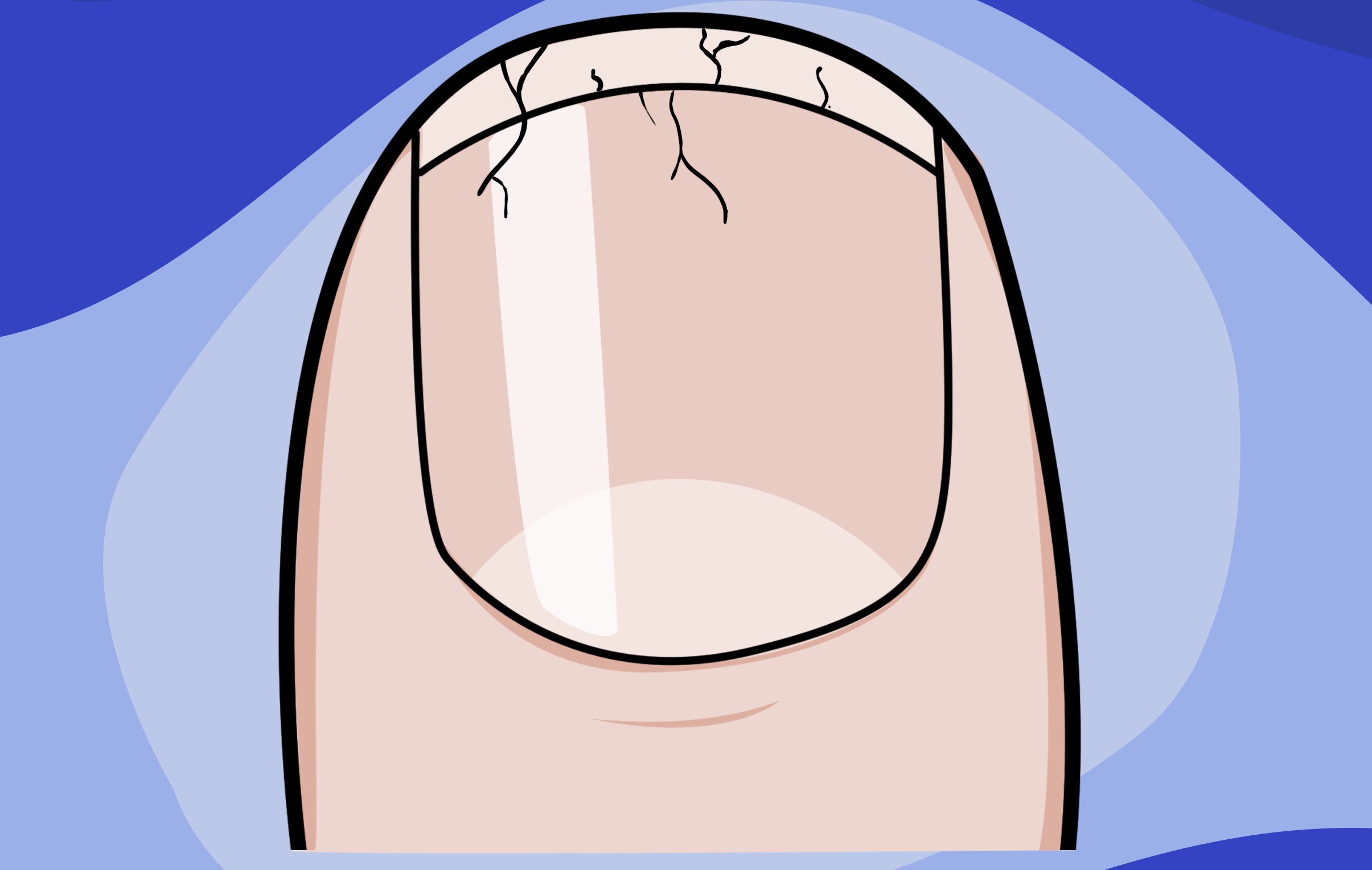 Medical infographic illustrating common nail abnormalities and their potential causes.