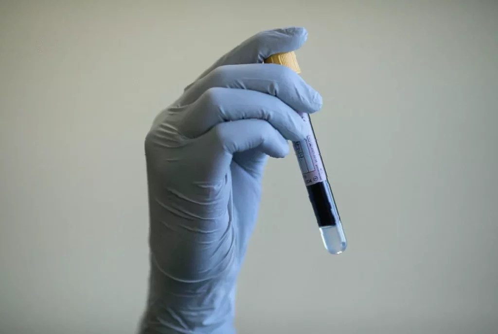 A doctor in a clinic reviewing a patient's diabetes health check results.