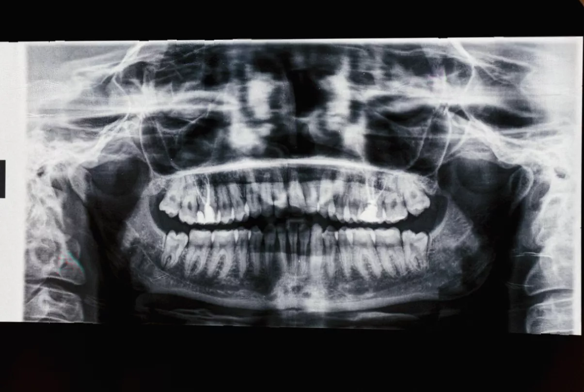 Infographic showing rising mouth cancer case statistics in the UK.