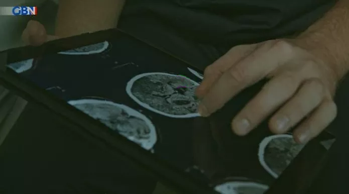 A researcher analysing data on vaccination and dementia rates.