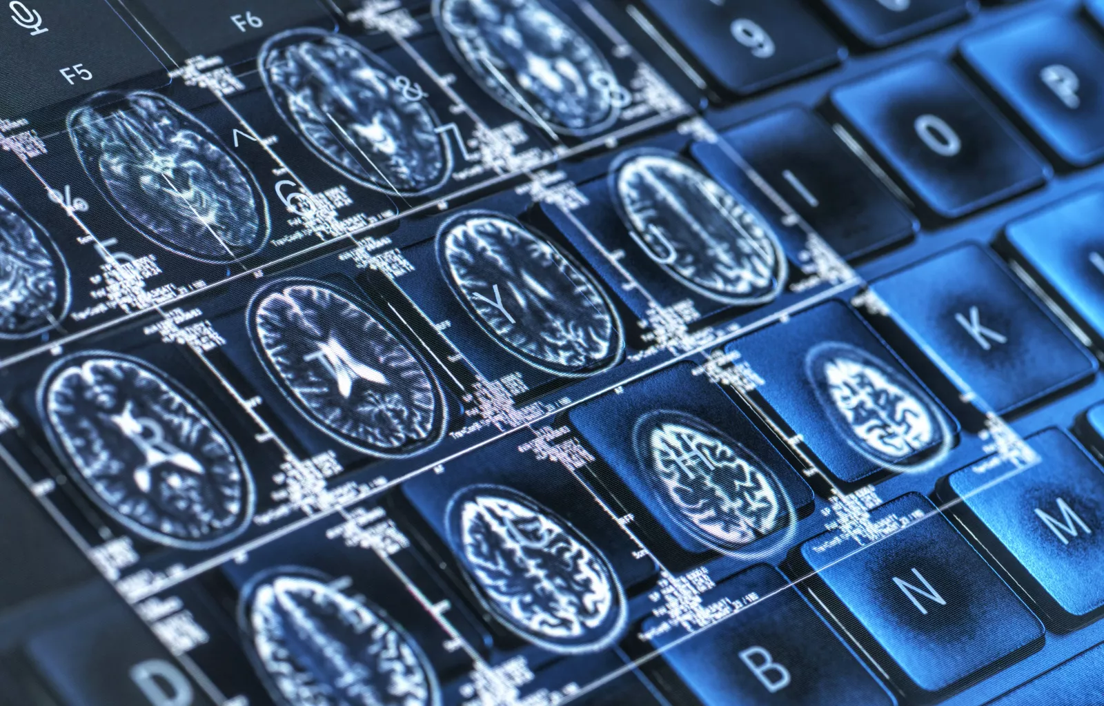 Conceptual image of a brain with a protective shield from a vaccine.