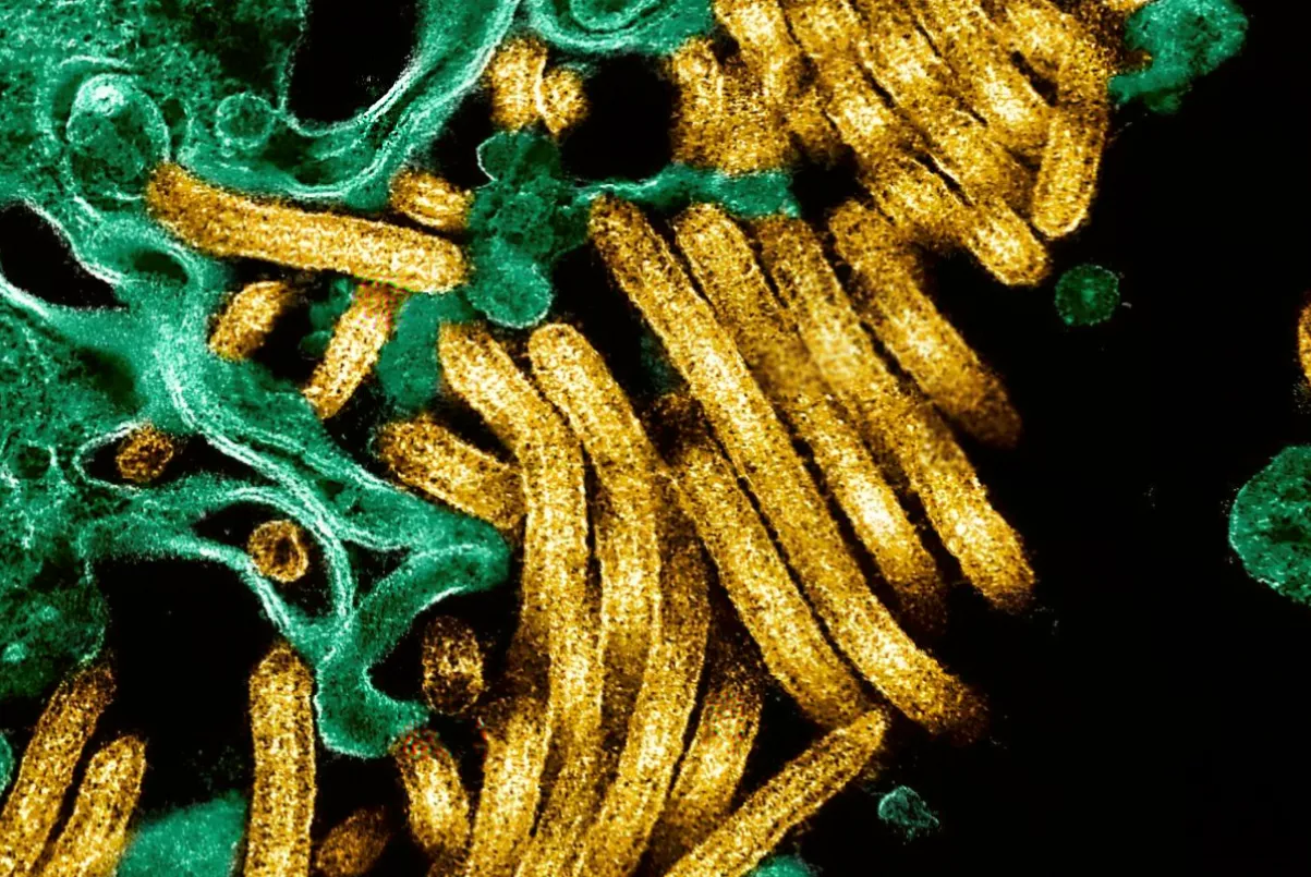 Health officials collecting samples from suspected Ebola patients in a rural clinic