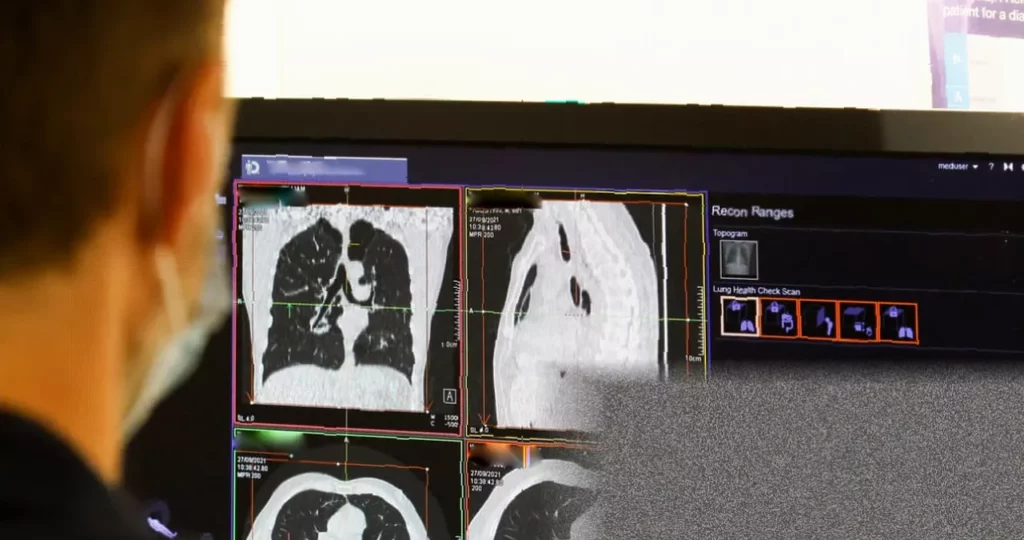 NHS pays record £241m to private firms for scan interpretation NHS hospital radiology department with CT scanner and reporting screens