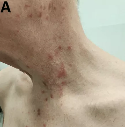 Exterior of a sauna in Barcelona linked to spread of the infection