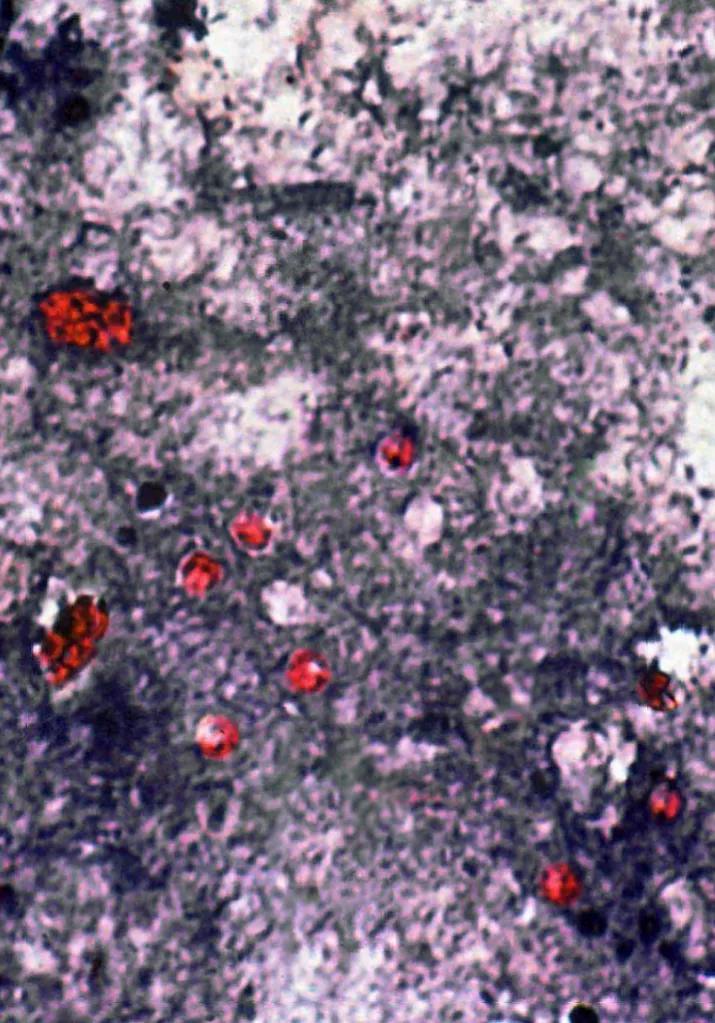 A health warning sign at a farm entrance during a cryptosporidiosis outbreak