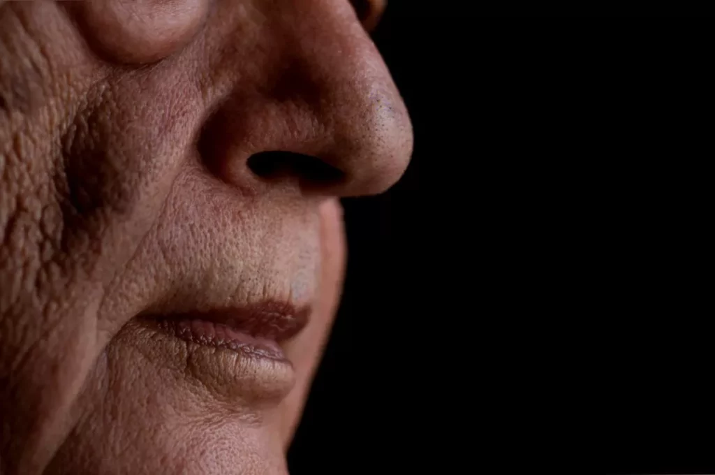 Doctors now regard condition affecting millions as akin to stroke and Parkinson’s Researcher reviewing clinical data on smell loss at University of East Anglia