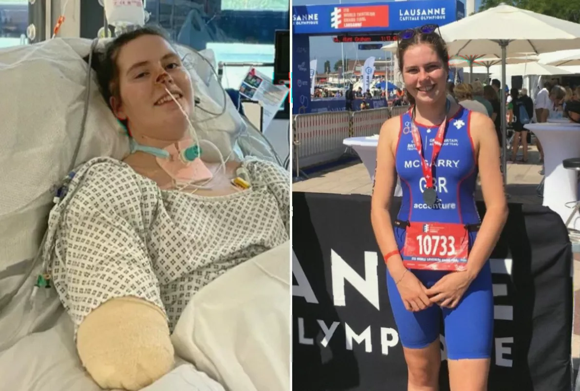 Young woman using prosthetic legs and a bionic arm during rehabilitation after sepsis