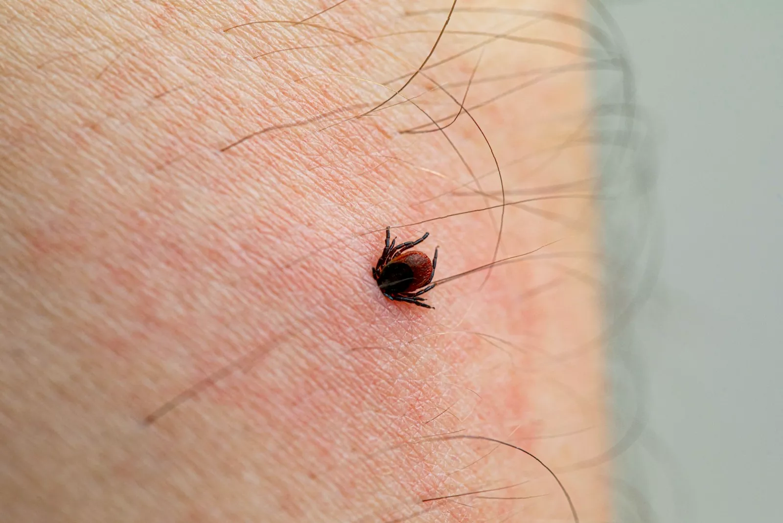 A person checking their lower leg for ticks after a countryside walk