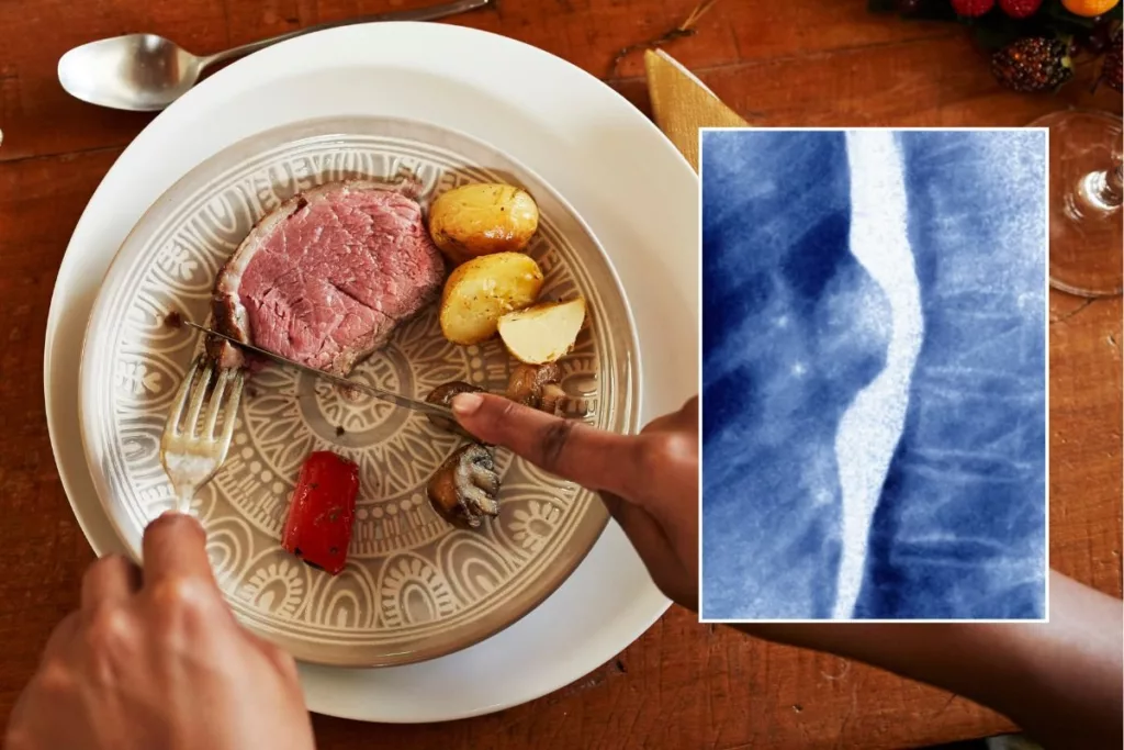 Women who eat certain meat face 20% higher stomach cancer risk, scientists caution Researcher analysing data from a long-term European cancer study