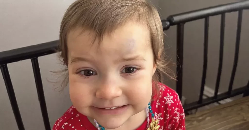 Toddler sitting on a hospital bed with a medical port visible on her chest
